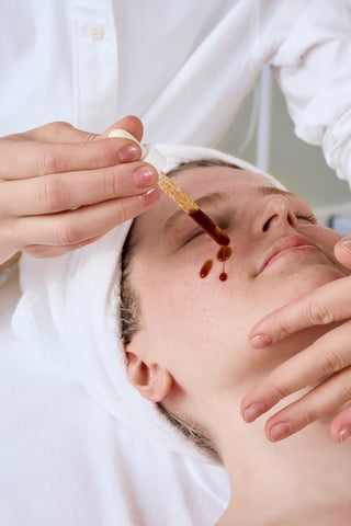 Medium Chemical Peel